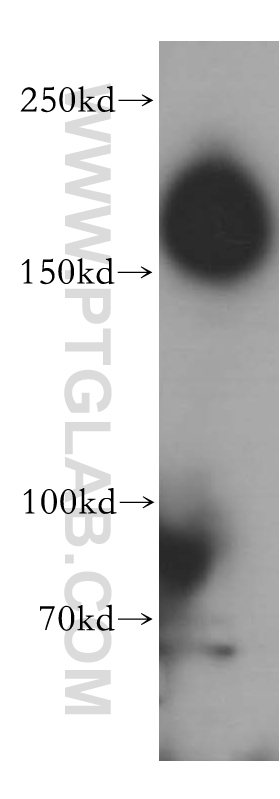 17880-1-AP;mouse brain tissue