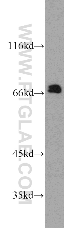 10120-1-AP;human placenta tissue