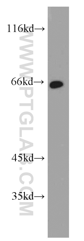 17556-1-AP;human stomach tissue