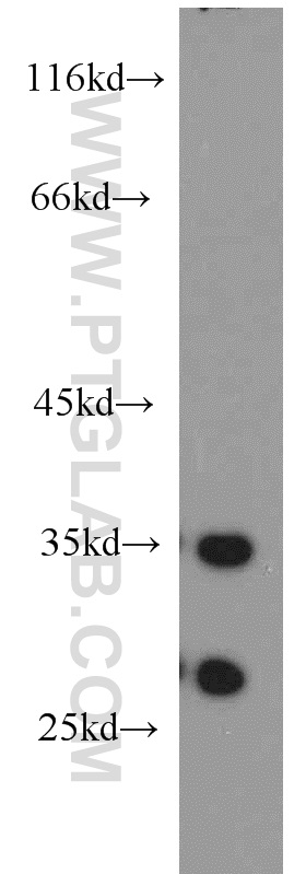 15803-1-AP;mouse skin tissue