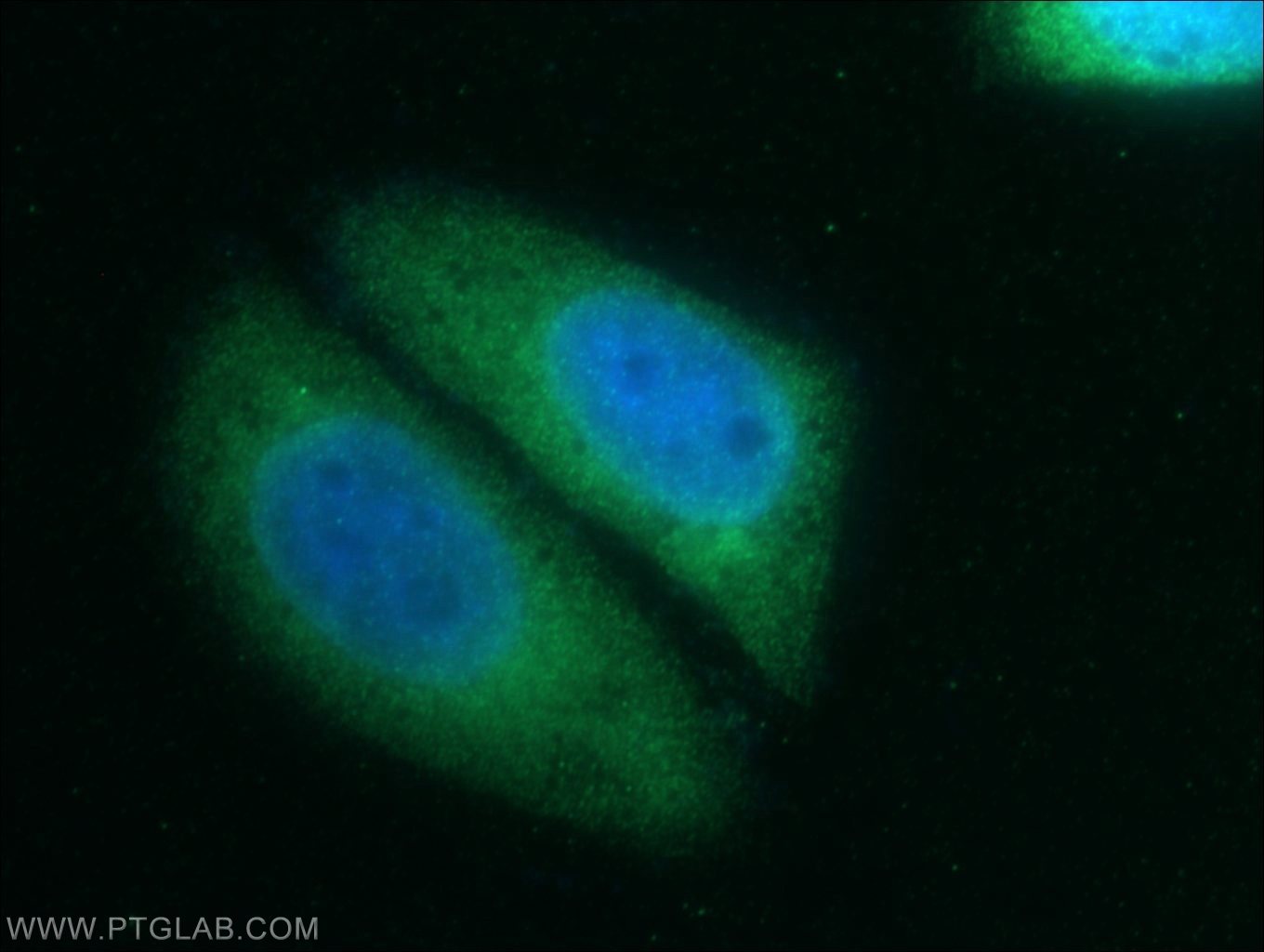 20766-1-AP;HepG2 cells