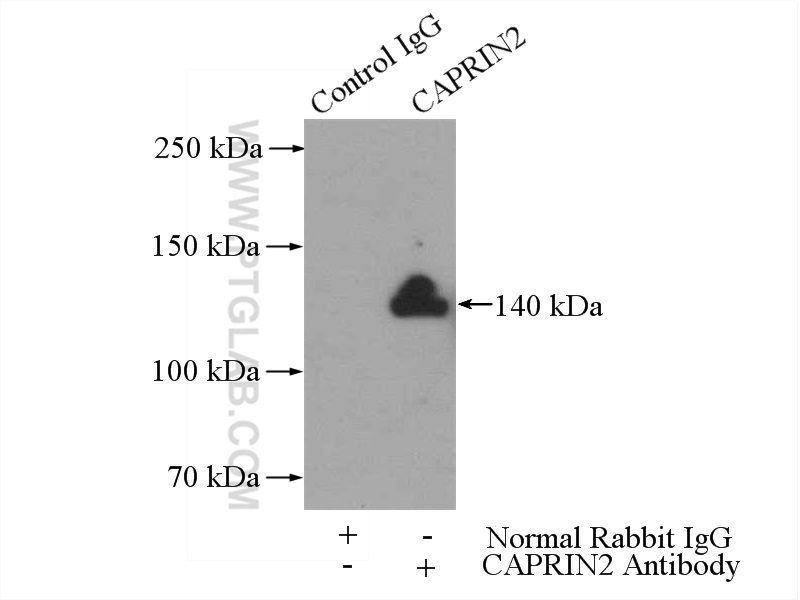 20766-1-AP;SH-SY5Y cells