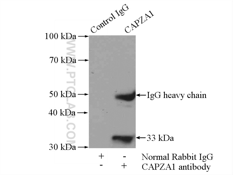 11806-1-AP;SH-SY5Y cells