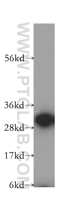 11806-1-AP;human brain tissue