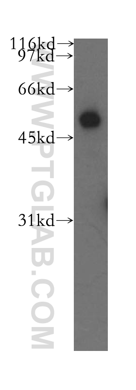 13104-1-AP;mouse lung tissue