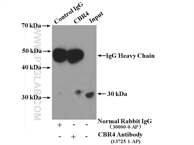 13725-1-AP;HepG2 cells