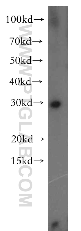 13725-1-AP;BxPC-3 cell