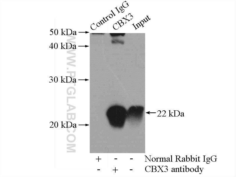 11650-2-AP;mouse spleen tissue