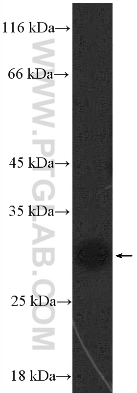 26278-1-AP;mouse liver tissue