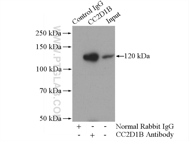 20774-1-AP;mouse brain tissue