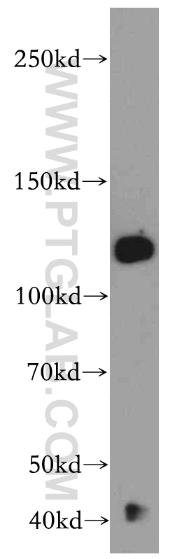 20774-1-AP;mouse brain tissue