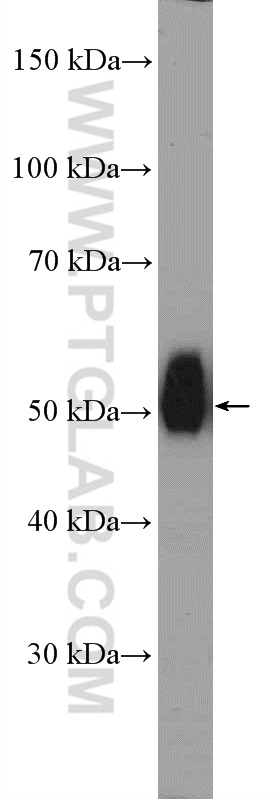 12156-1-AP;mouse kidney tissue