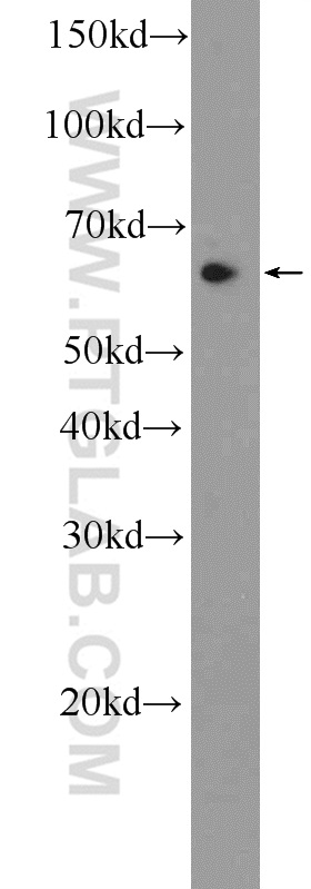 25764-1-AP;HeLa cells