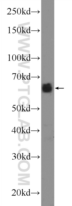 24579-1-AP;mouse brain tissue