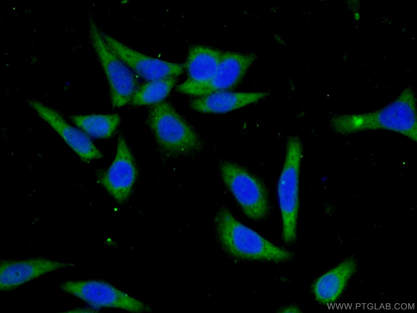 18282-1-AP;HeLa cells