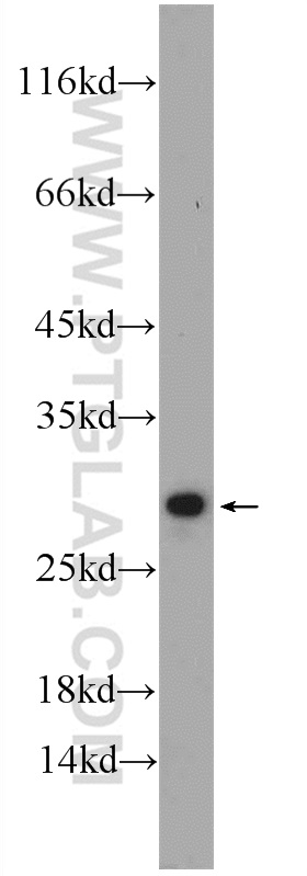 18282-1-AP;mouse heart tissue