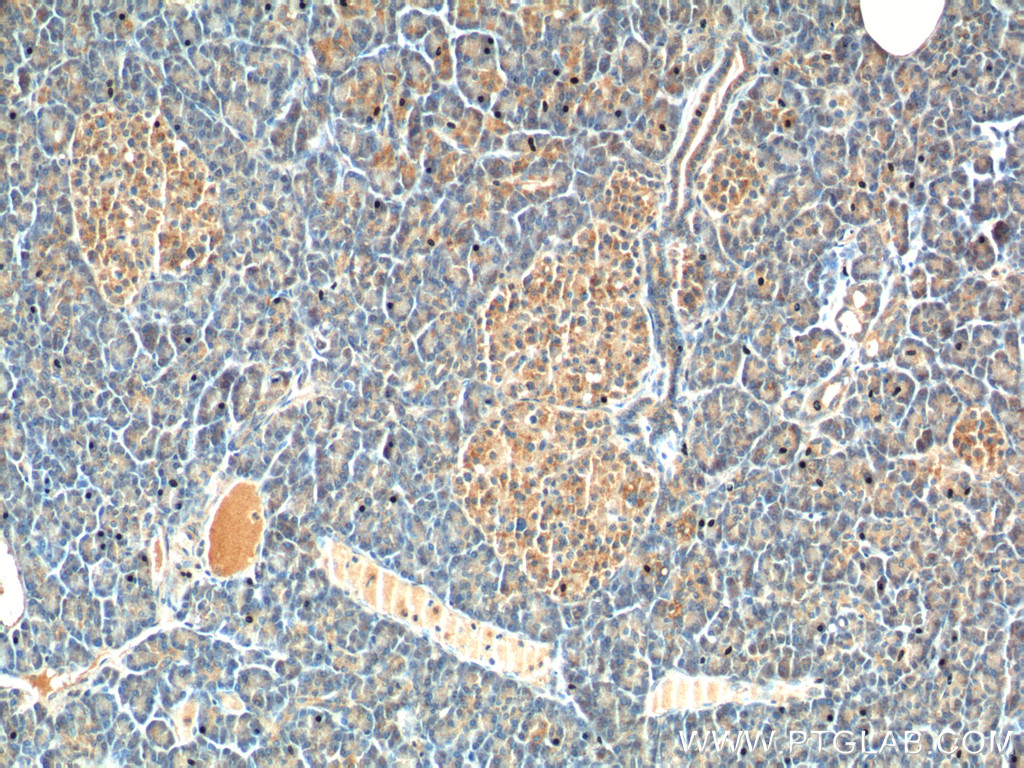 13074-2-AP;human pancreas tissue
