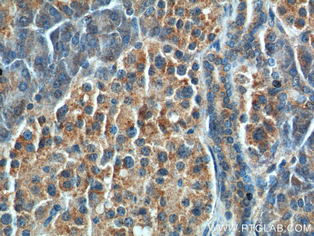 13074-2-AP;human pancreas tissue