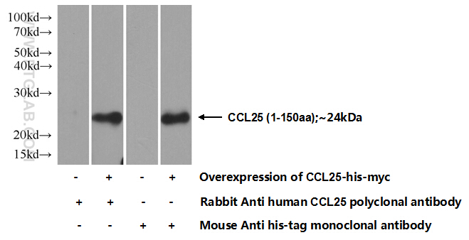 25285-1-AP;Transfected HEK-293 cells