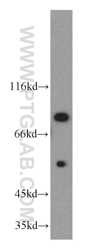 20992-1-AP;K-562 cell