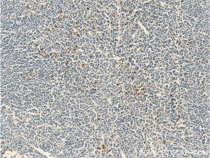 22351-1-AP;human tonsillitis tissue