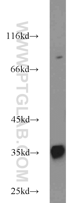 22802-1-AP;HepG2 cells