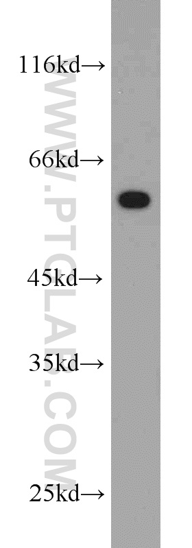 11603-1-AP;HeLa cells