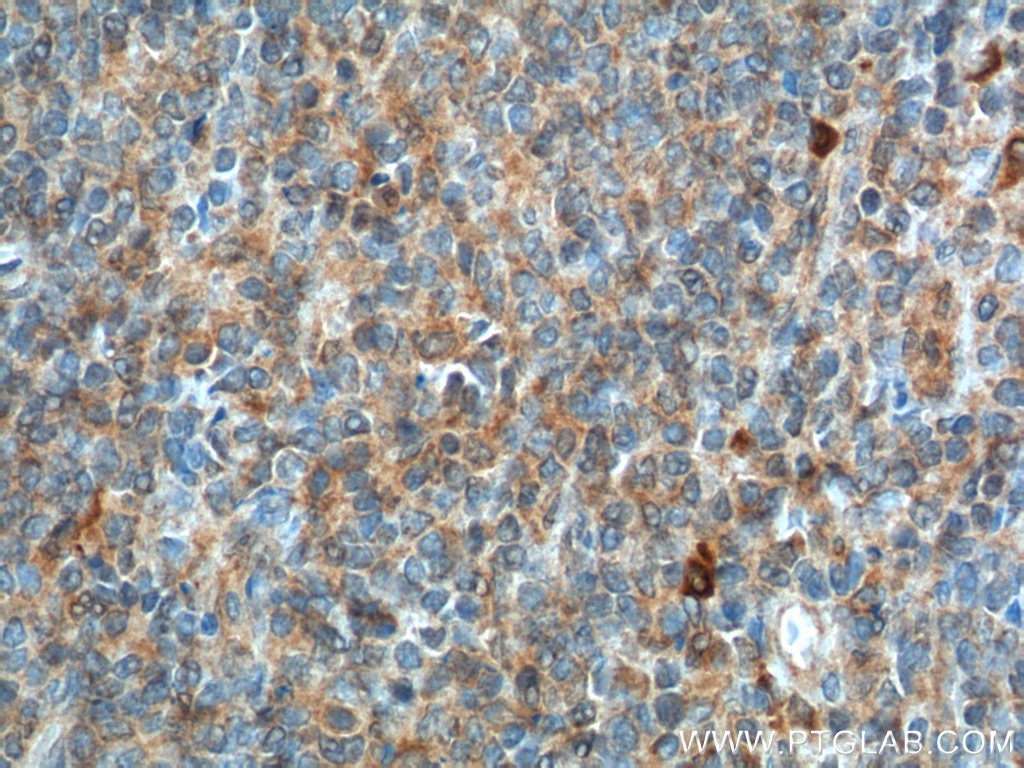 17842-1-AP;human tonsillitis tissue