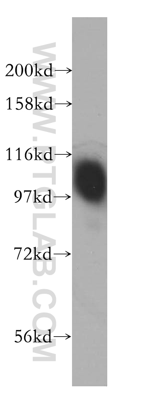 14453-1-AP;PC-3 cells