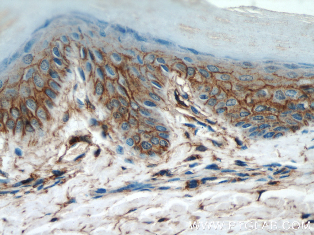 Cd Antibody Ap Proteintech