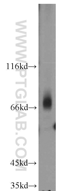 17227-1-AP;Jurkat cells