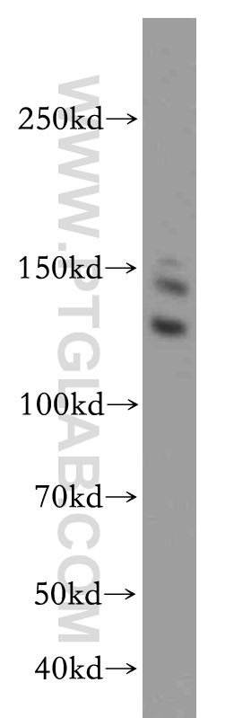 17597-1-AP;HeLa cell