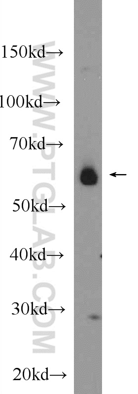 25187-1-AP;SMMC-7721 cells