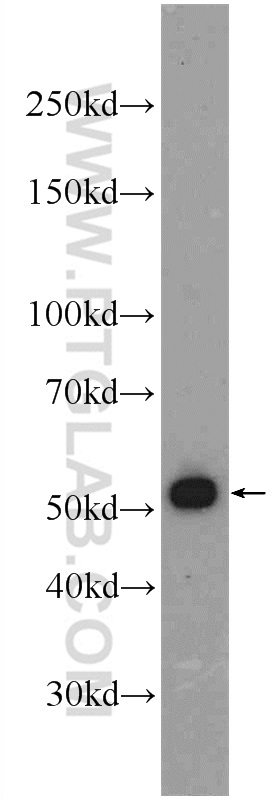 10252-1-AP;Jurkat cells