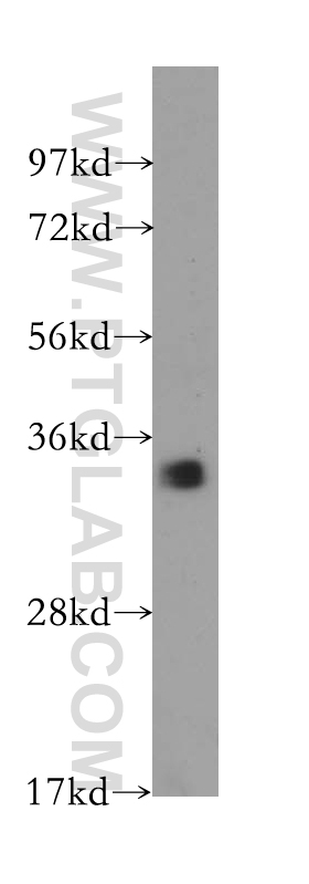 10964-2-AP;human pancreas tissue