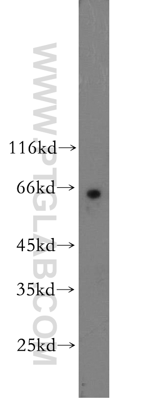 17980-1-AP;SH-SY5Y cell