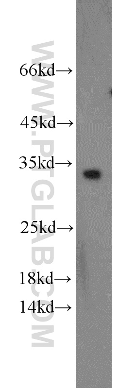 11625-1-AP;HeLa cells