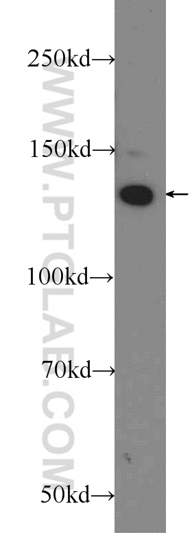 24428-1-AP;HeLa cells