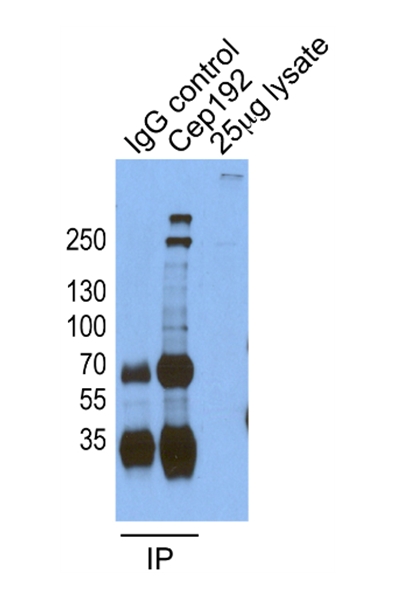 18832-1-AP;HeLa cells