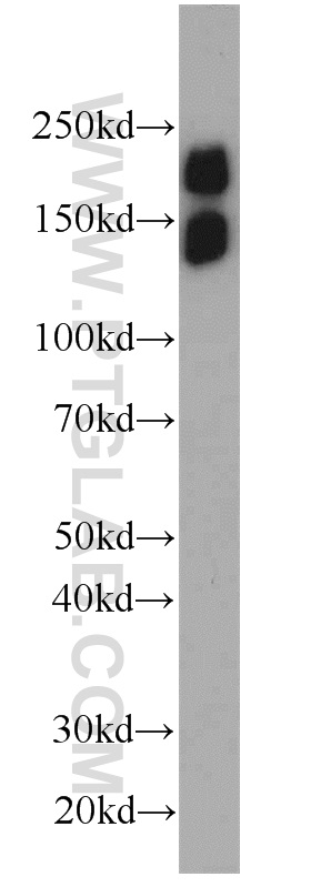 20022-1-AP;mouse heart tissue