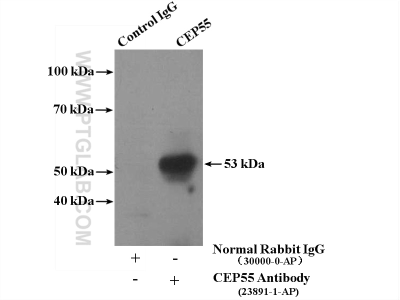 23891-1-AP;mouse testis tissue