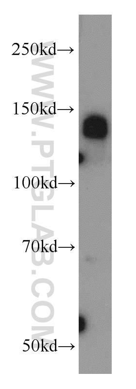 22050-1-AP;HL-60 cell