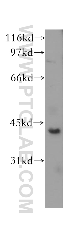 12963-1-AP;MCF7 cell