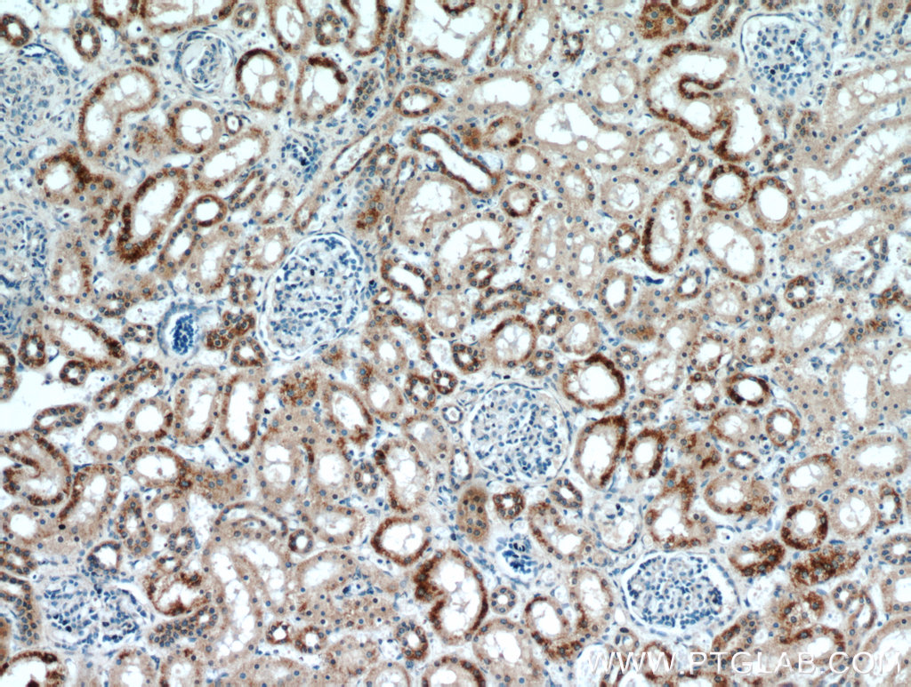 21090-1-AP;human kidney tissue