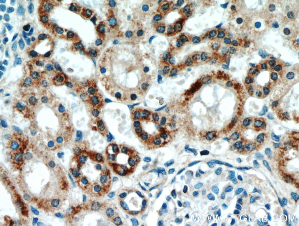 21090-1-AP;human kidney tissue