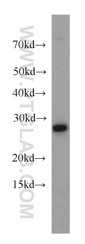 20639-1-AP;HeLa cell