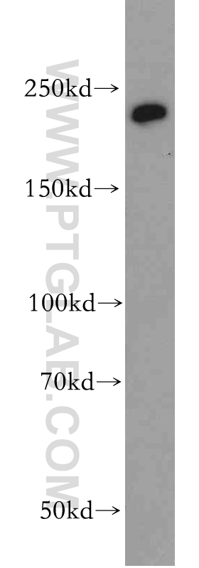 20576-1-AP;HeLa cell