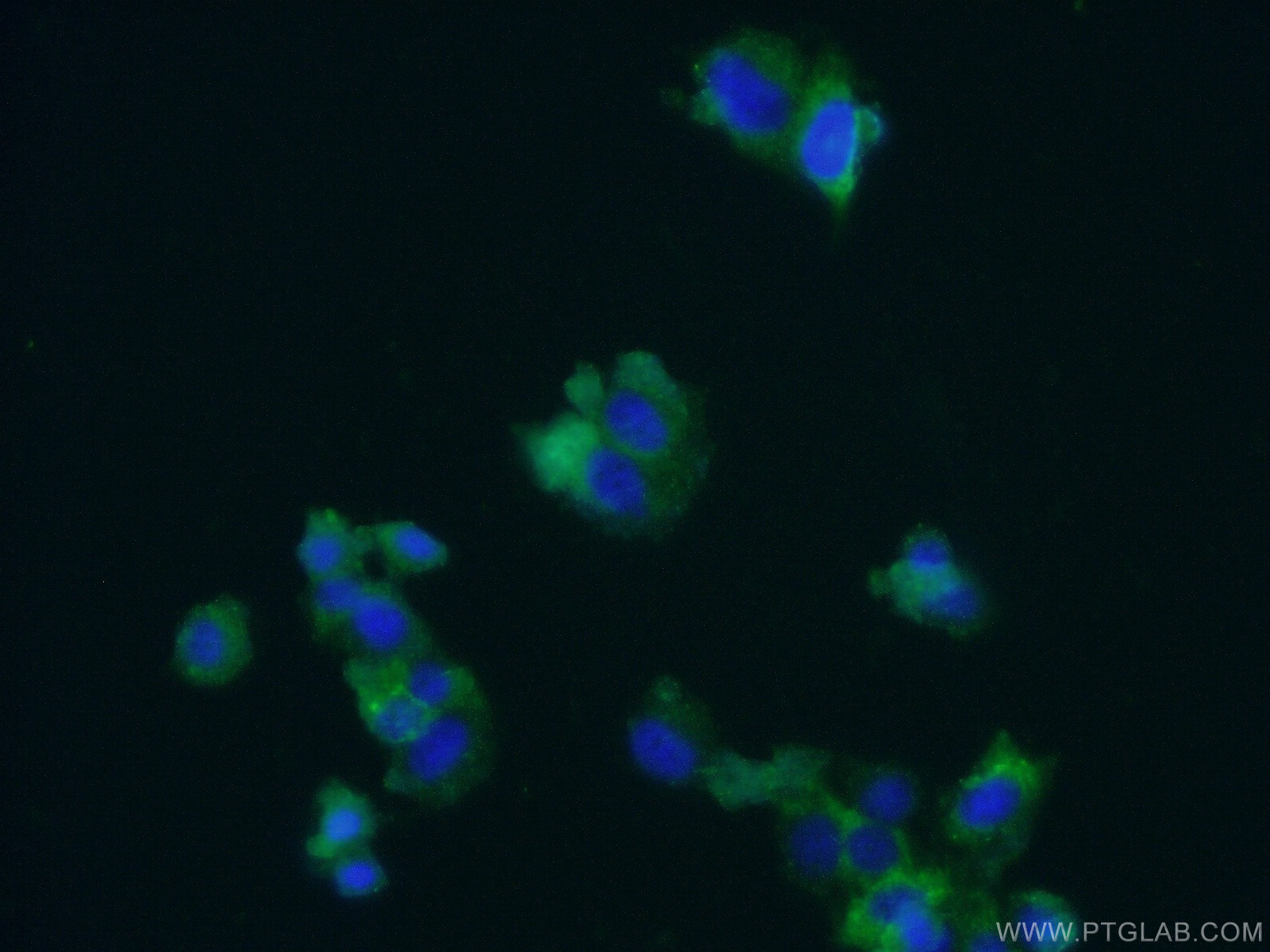 Chromogranin B Antibody 14968-1-AP | Proteintech