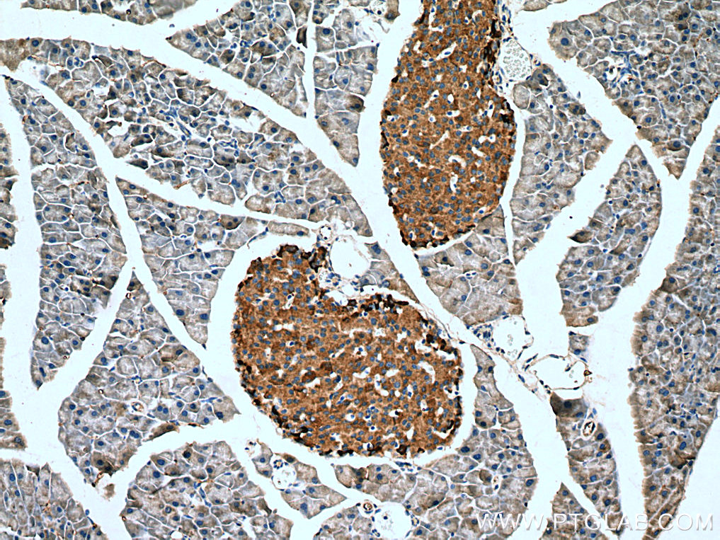 Chromogranin B Antibody 14968-1-AP | Proteintech