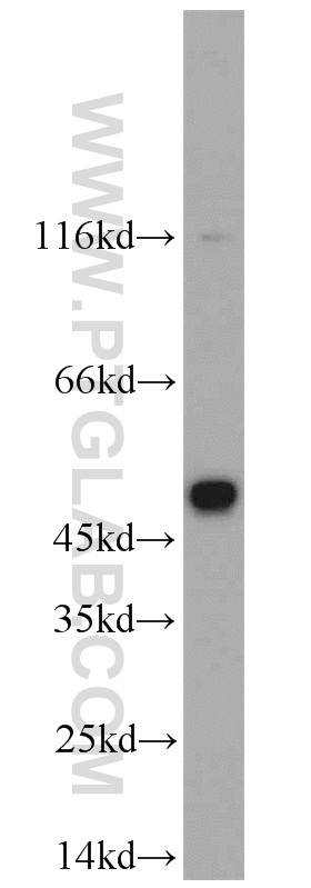 22192-1-AP;SH-SY5Y cell